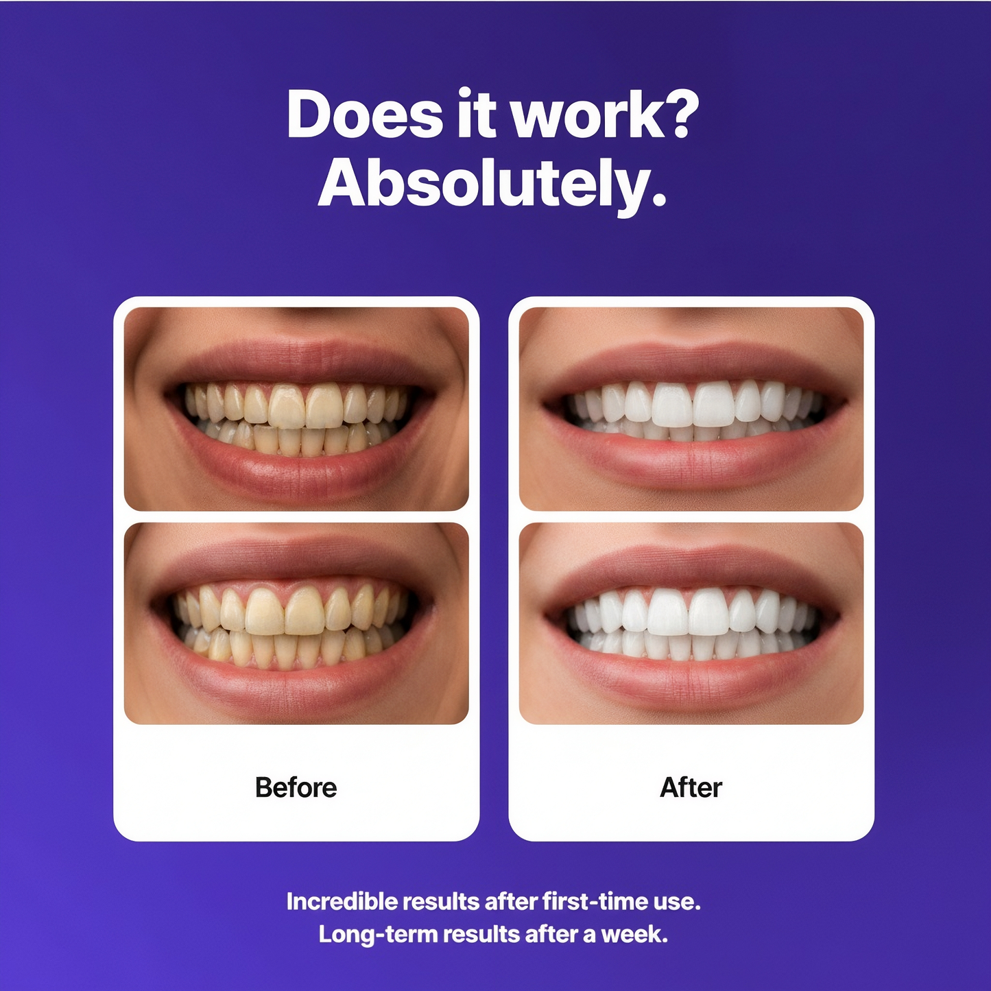 FadeScape Whitening Strips